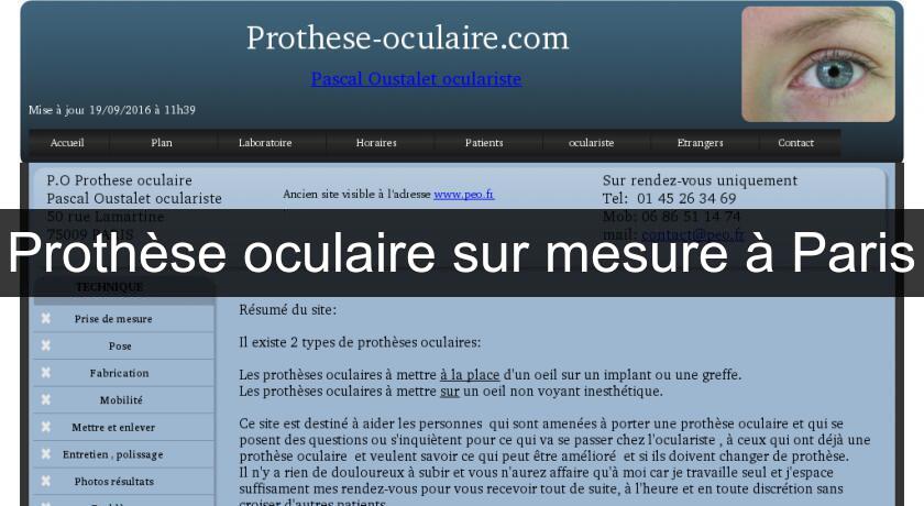 Prothèse oculaire sur mesure à Paris