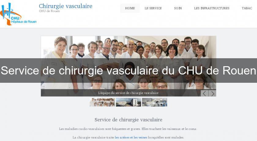 Service de chirurgie vasculaire du CHU de Rouen Service de chirurgie vasculaire du CHU de Rouen