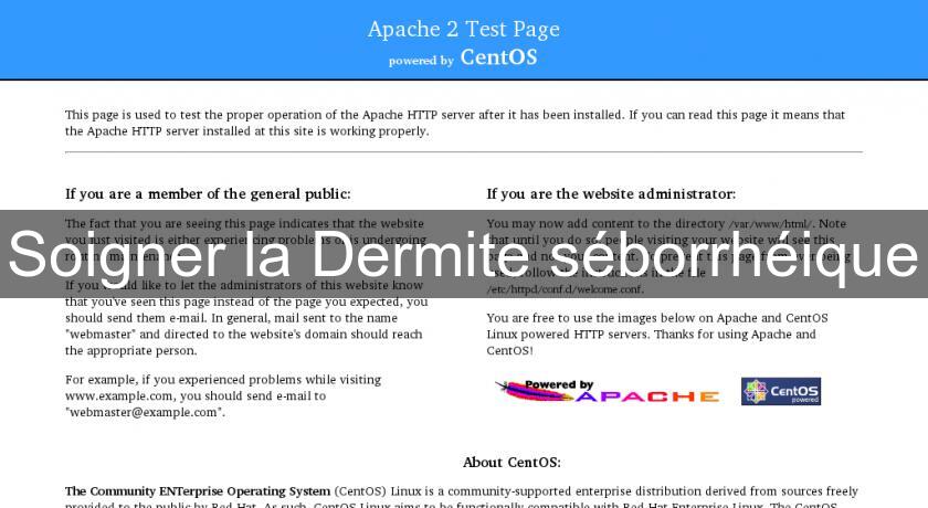 Soigner la Dermite séborrhéique Soigner la Dermite séborrhéique