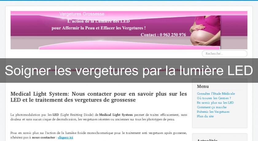 Soigner les vergetures par la lumière LED Soigner les vergetures par la lumière LED