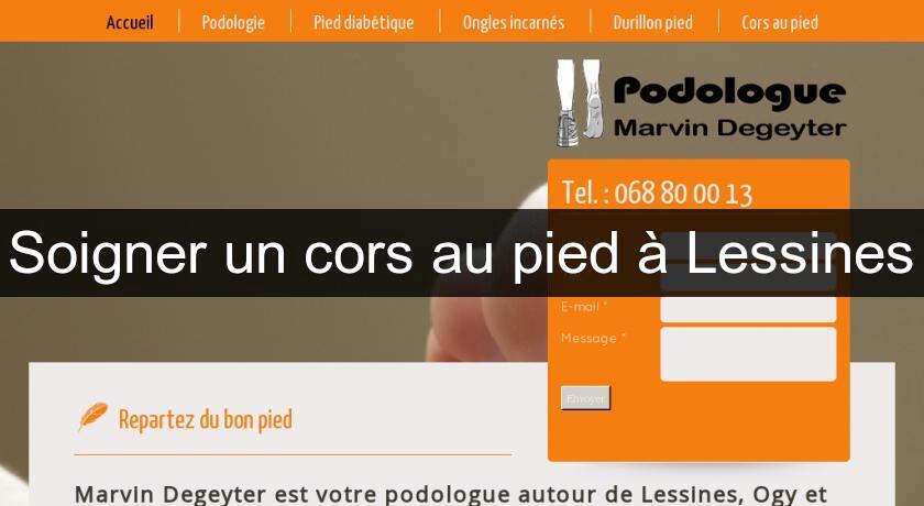Soigner un cors au pied à Lessines Soigner un cors au pied à Lessines
