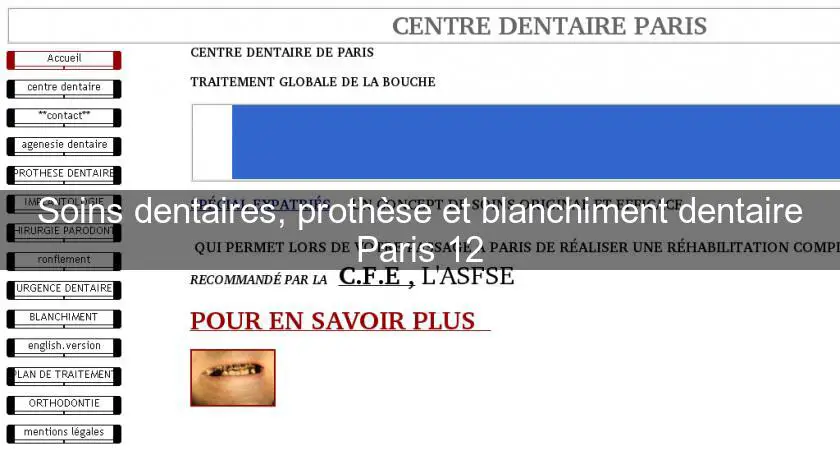 Soins dentaires, prothèse et blanchiment dentaire Paris 12
