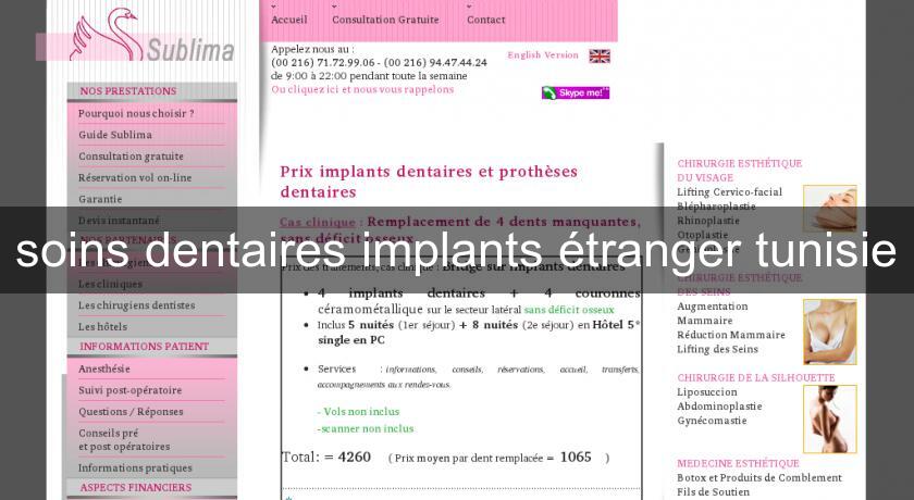 soins dentaires implants étranger tunisie soins dentaires implants étranger tunisie