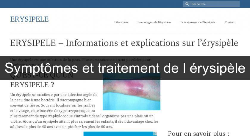 Symptômes et traitement de l'érysipèle Symptômes et traitement de l'érysipèle