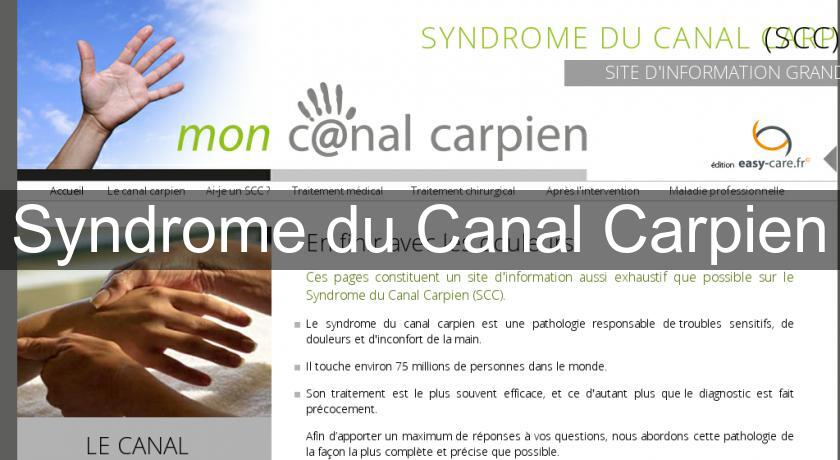Syndrome du Canal Carpien Syndrome du Canal Carpien