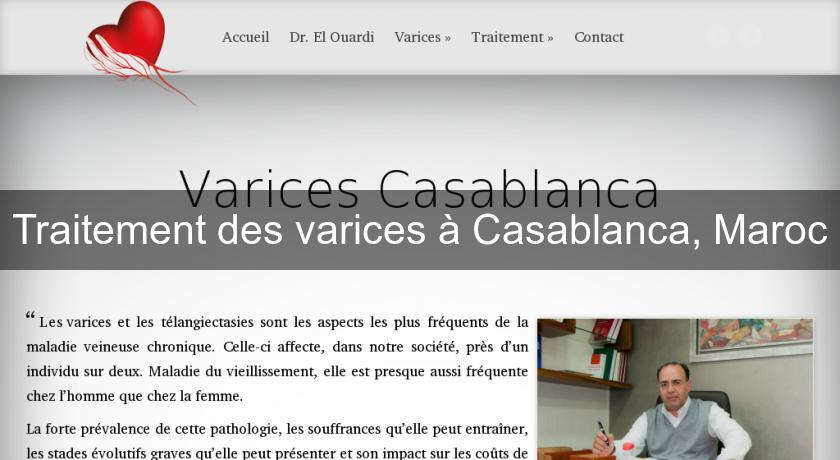 Traitement des varices à Casablanca, Maroc