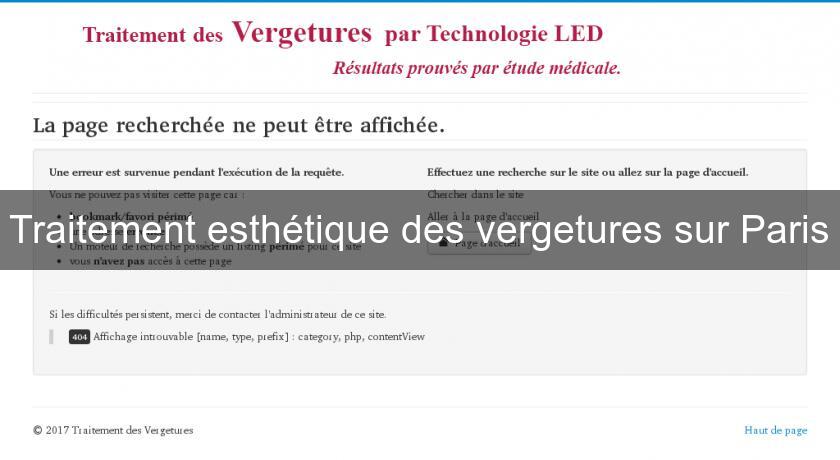 Traitement esthétique des vergetures sur Paris Traitement esthétique des vergetures sur Paris