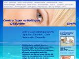 Soins esthétiques laser à Deauville