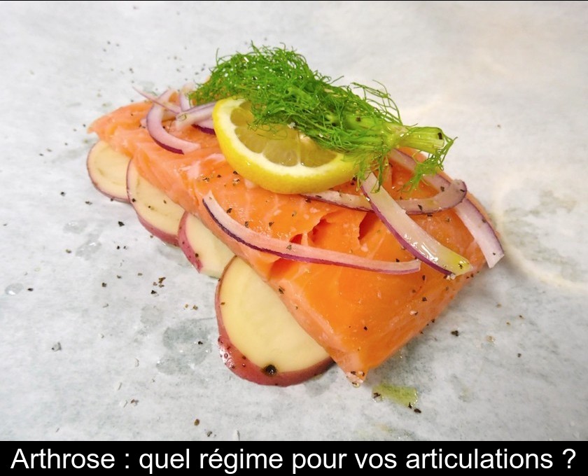 Arthrose : quel régime pour vos articulations ? Arthrose : quel régime pour vos articulations ?
