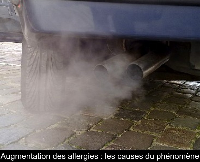 Augmentation des allergies : les causes du phénomène Augmentation des allergies : les causes du phénomène