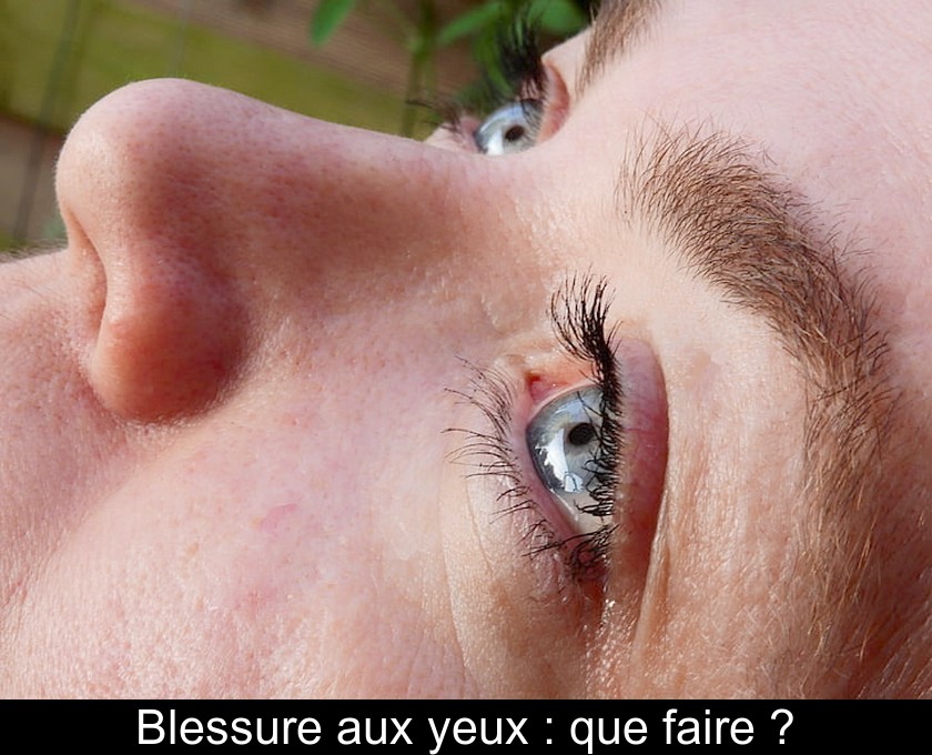Blessure aux yeux : que faire ? Blessure aux yeux : que faire ?