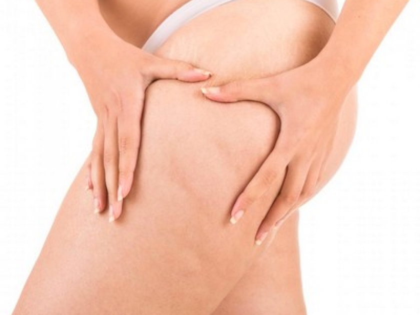 Cellulite : 5 choses à savoir pour un massage efficace Cellulite : 5 choses à savoir pour un massage efficace