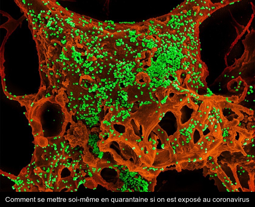 Comment se mettre soi-même en quarantaine si on est exposé au coronavirus Comment se mettre soi-même en quarantaine si on est exposé au coronavirus