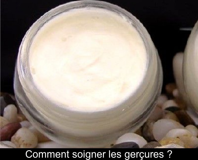 Comment soigner les gerçures ? Comment soigner les gerçures ?