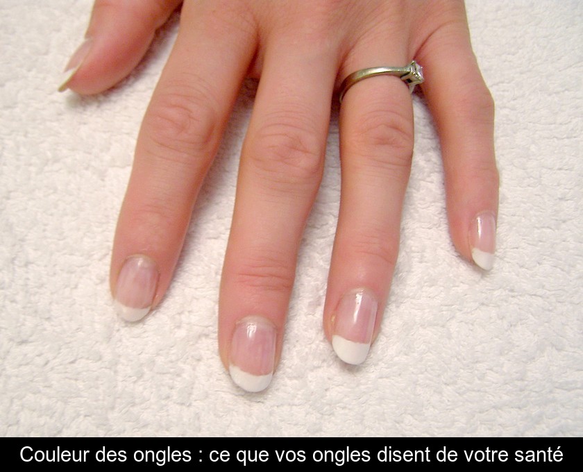 Couleur des ongles : ce que vos ongles disent de votre santé