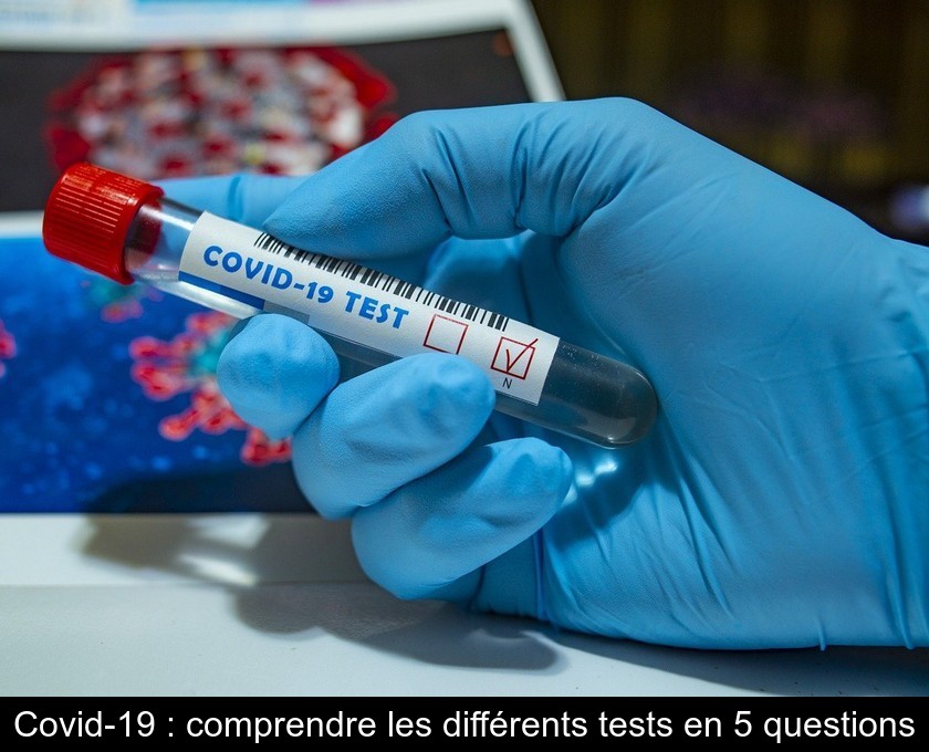 Covid-19 : comprendre les différents tests en 5 questions Covid-19 : comprendre les différents tests en 5 questions