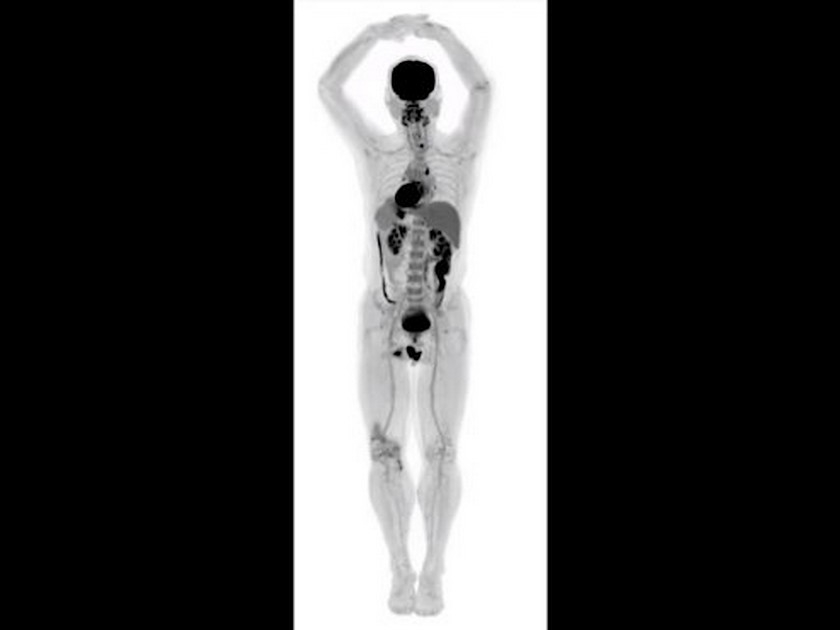 Innovation : un scanner 3D permet de visualiser le corps humain dans son ensemble Innovation : un scanner 3D permet de visualiser le corps humain dans son ensemble