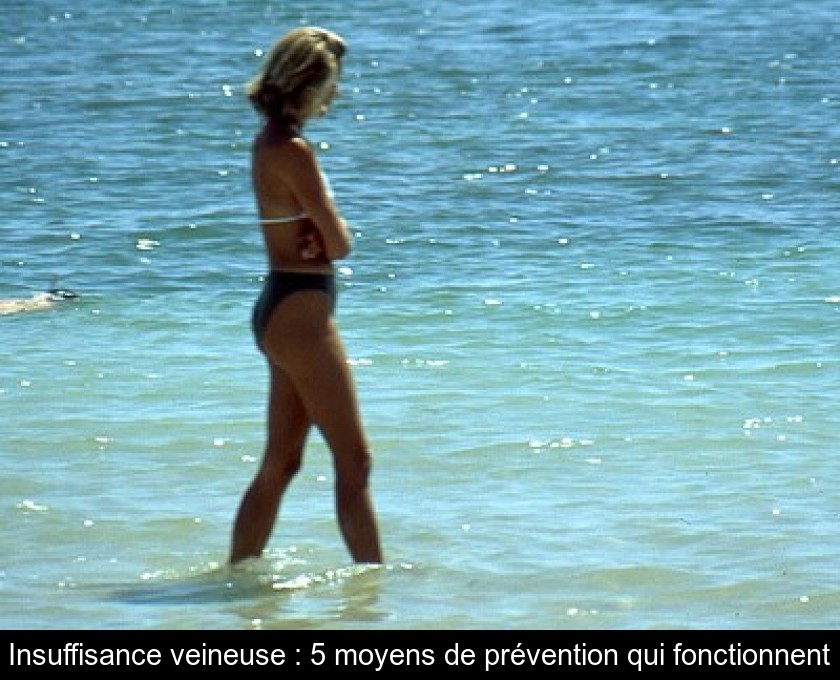 Insuffisance veineuse : 5 moyens de prévention qui fonctionnent Insuffisance veineuse : 5 moyens de prévention qui fonctionnent