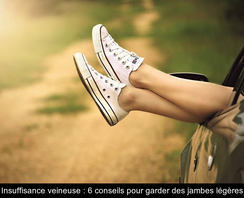 Insuffisance veineuse : 6 conseils pour garder des jambes légères