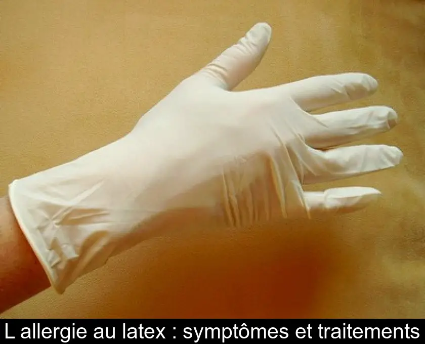 L'allergie au latex : symptômes et traitements