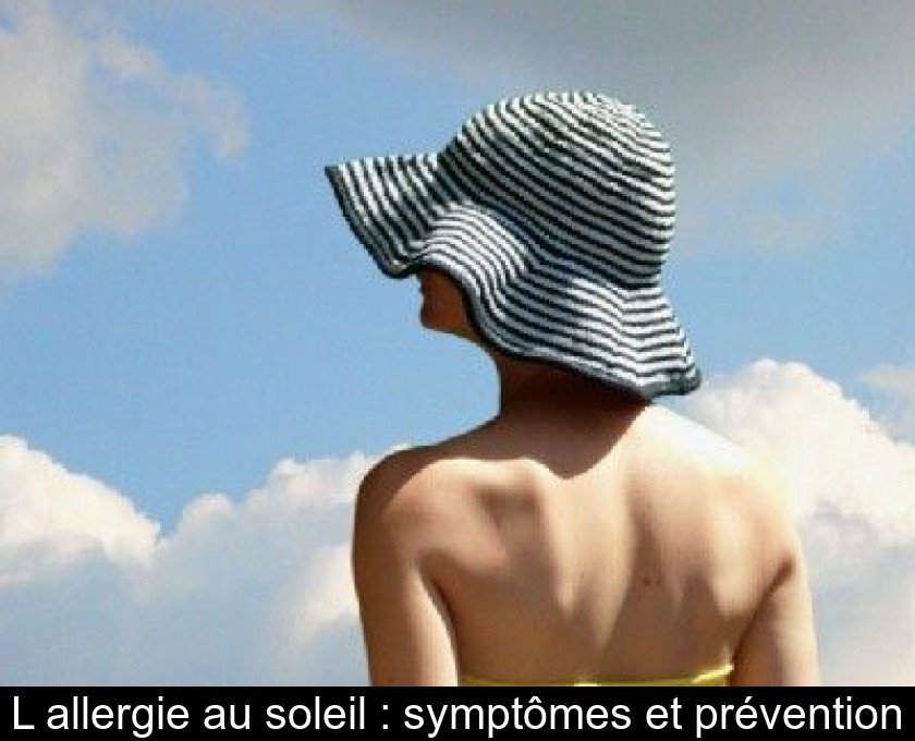 L'allergie au soleil : symptômes et prévention L'allergie au soleil : symptômes et prévention