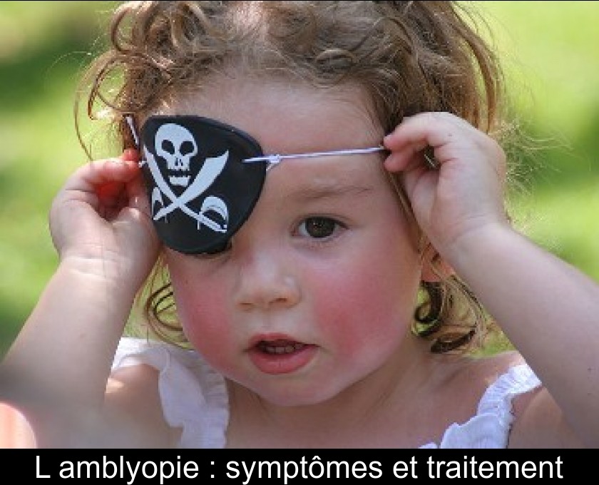 L'amblyopie : symptômes et traitement L'amblyopie : symptômes et traitement