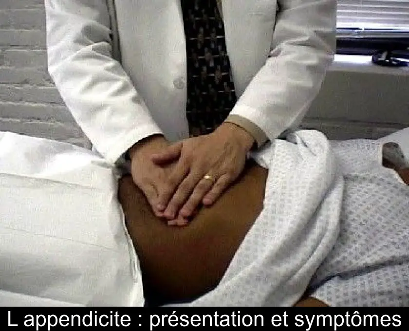 L'appendicite : présentation et symptômes