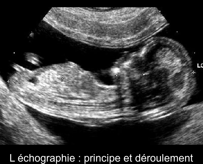 L'échographie : principe et déroulement L'échographie : principe et déroulement
