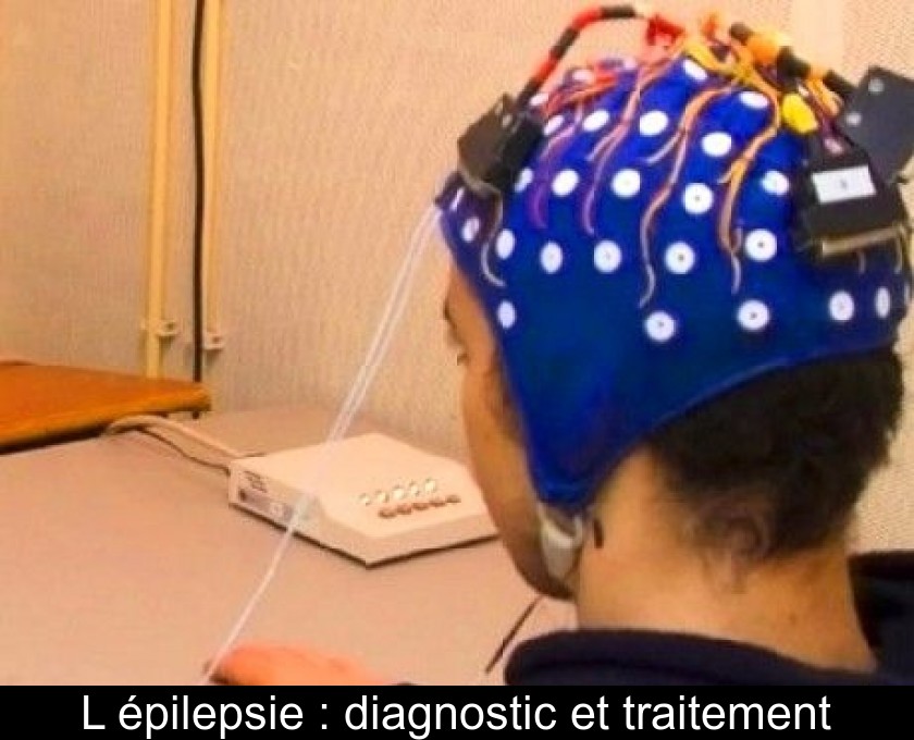 L'épilepsie : diagnostic et traitement L'épilepsie : diagnostic et traitement