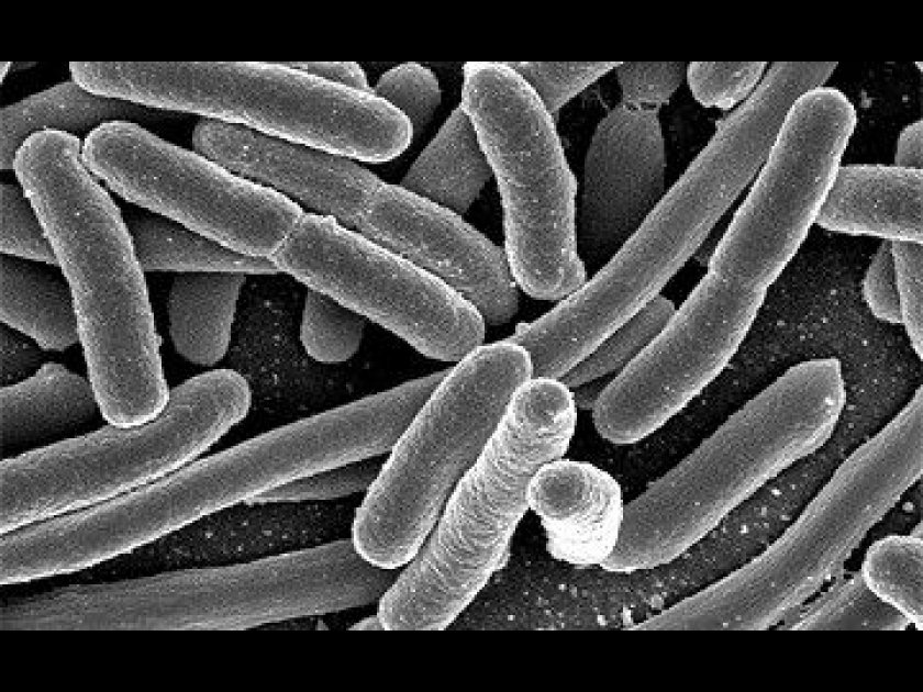 L'escherichia coli : risques et prévention L'escherichia coli : risques et prévention