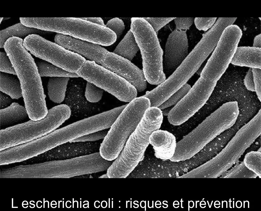 L'escherichia coli : risques et prévention