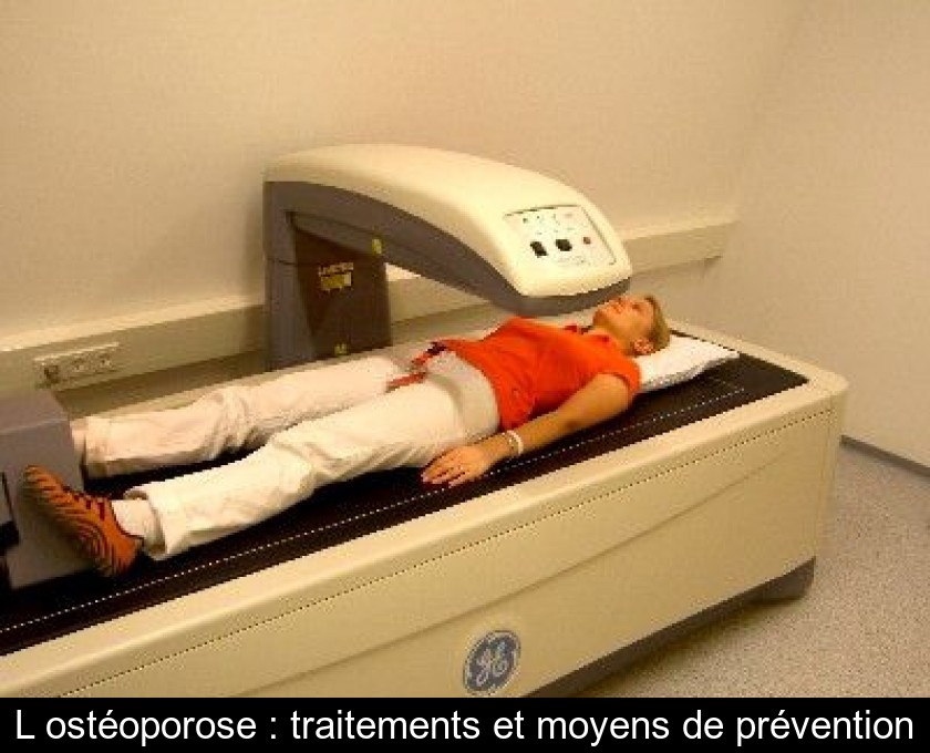 L'ostéoporose : traitements et moyens de prévention L'ostéoporose : traitements et moyens de prévention