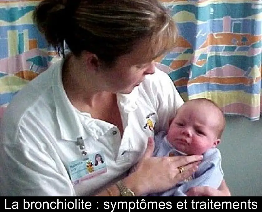 La bronchiolite : symptômes et traitements