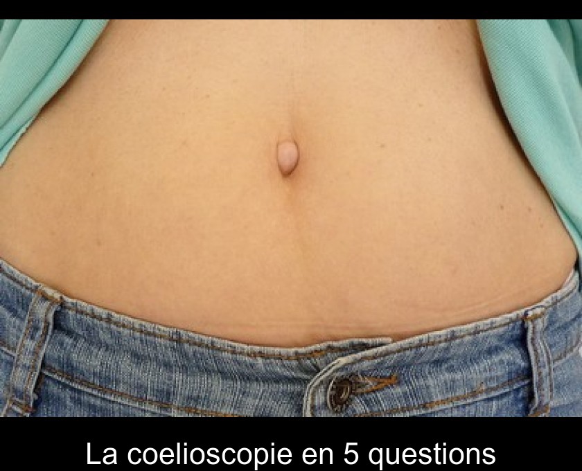 La coelioscopie en 5 questions