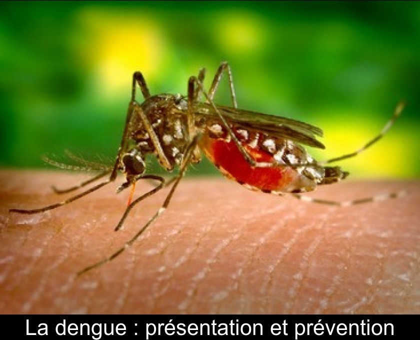 La dengue : présentation et prévention La dengue : présentation et prévention