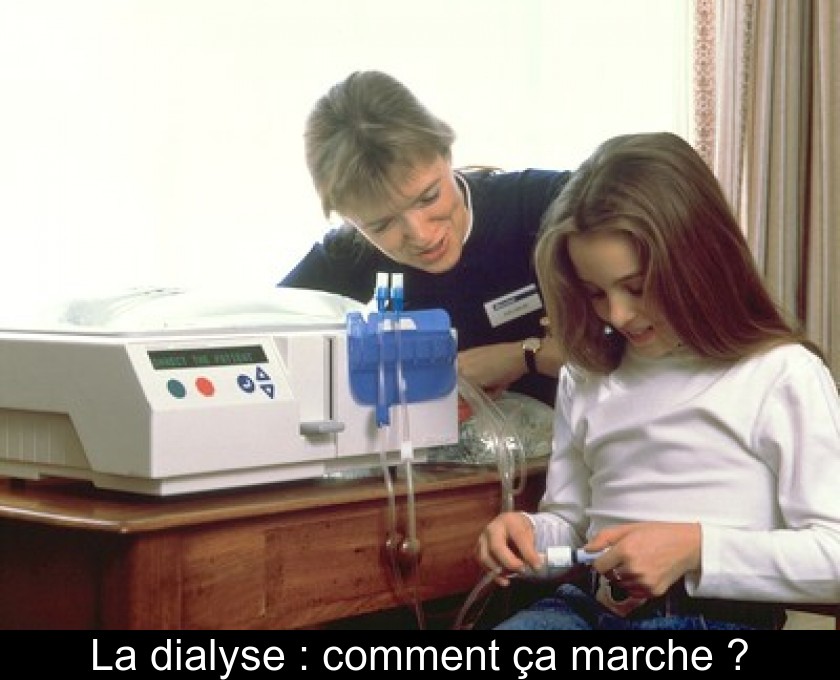 La dialyse : comment ça marche ? La dialyse : comment ça marche ?