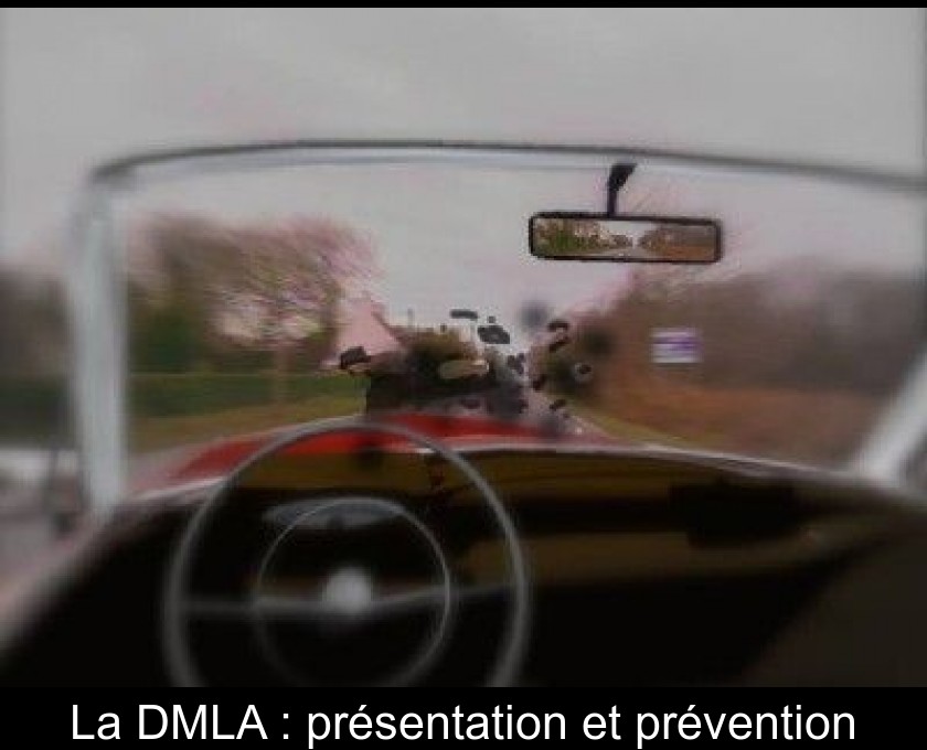 La DMLA : présentation et prévention La DMLA : présentation et prévention