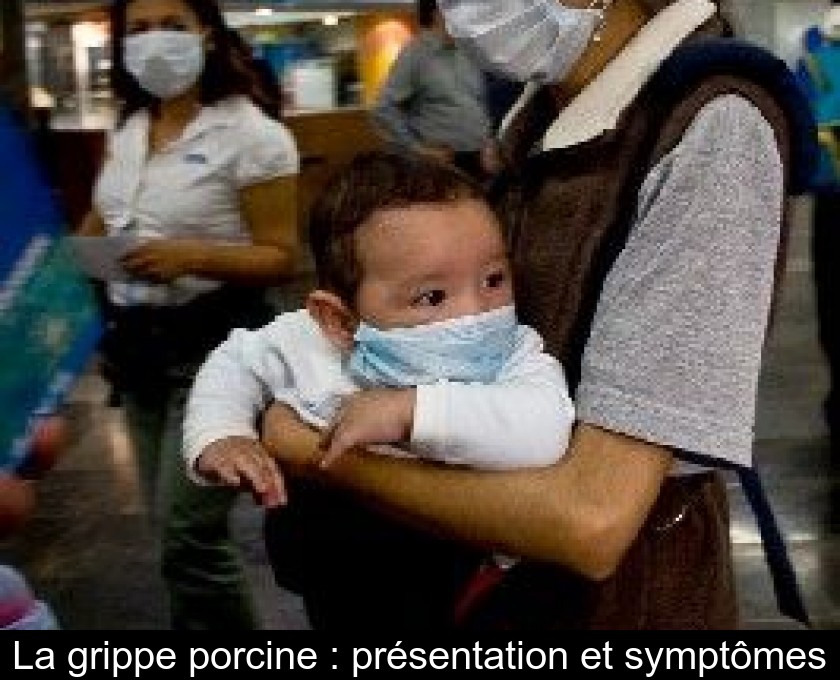 La grippe porcine : présentation et symptômes La grippe porcine : présentation et symptômes