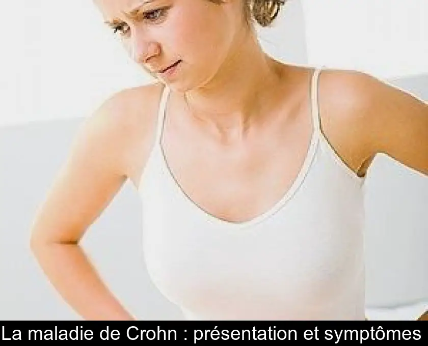 La maladie de Crohn : présentation et symptômes 