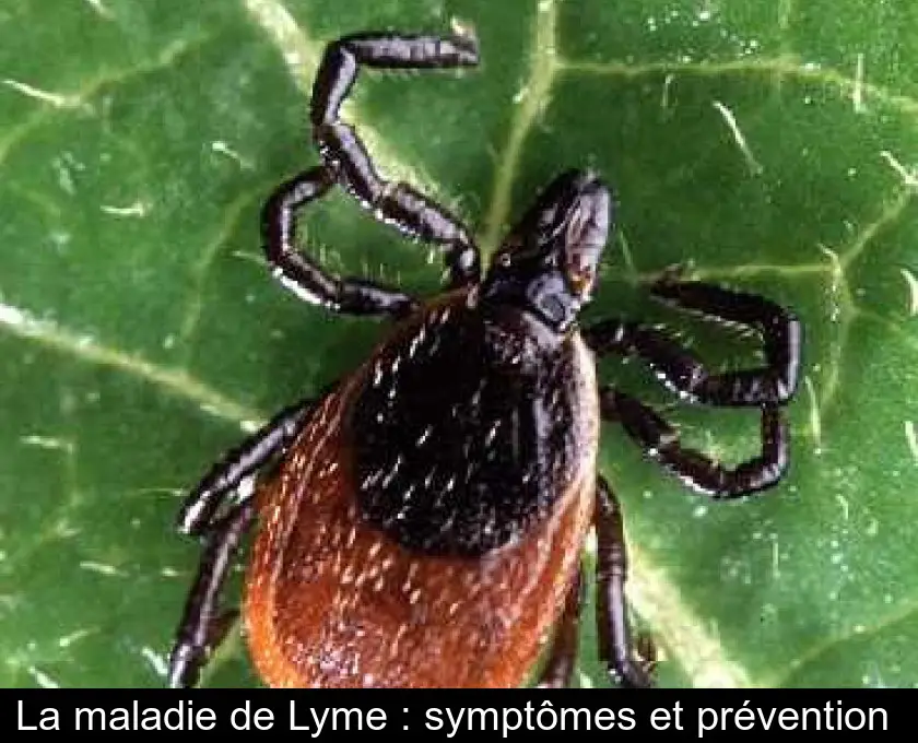 La maladie de Lyme : symptômes et prévention 