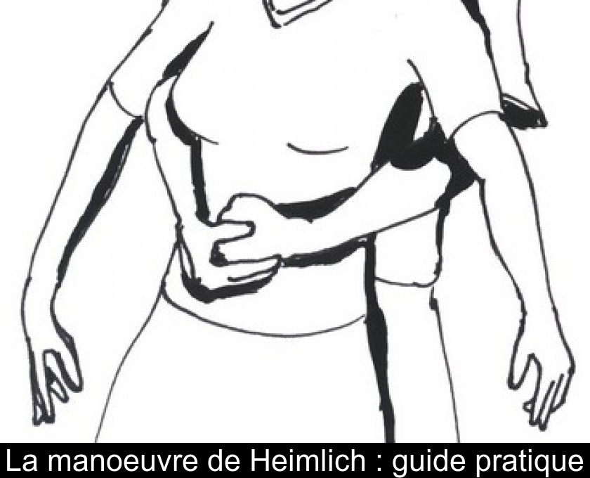 La manoeuvre de Heimlich : guide pratique La manoeuvre de Heimlich : guide pratique