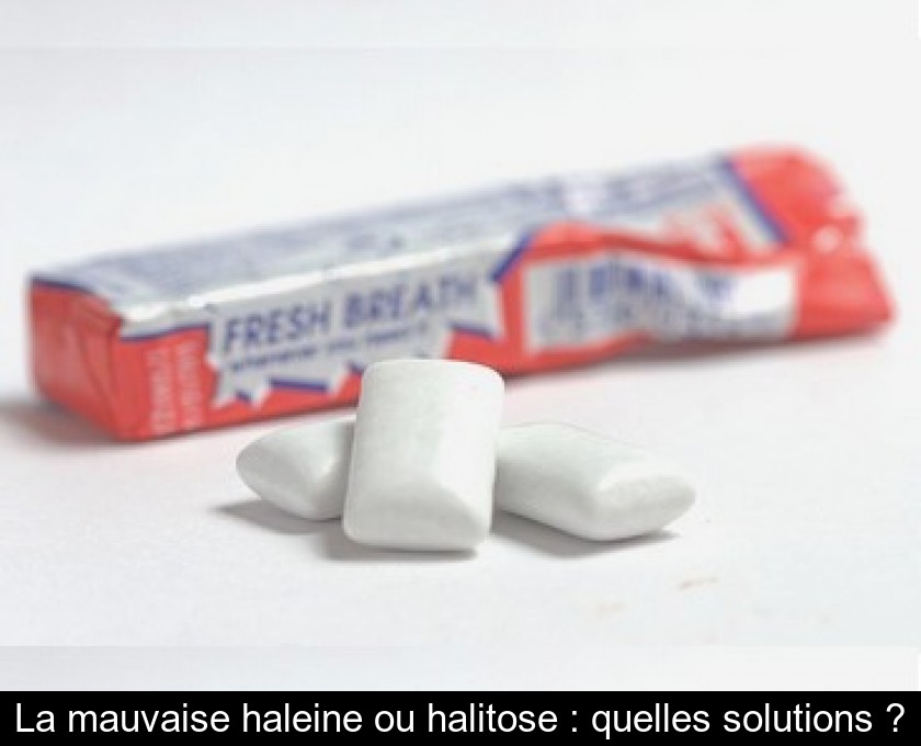 La mauvaise haleine ou halitose : quelles solutions ?