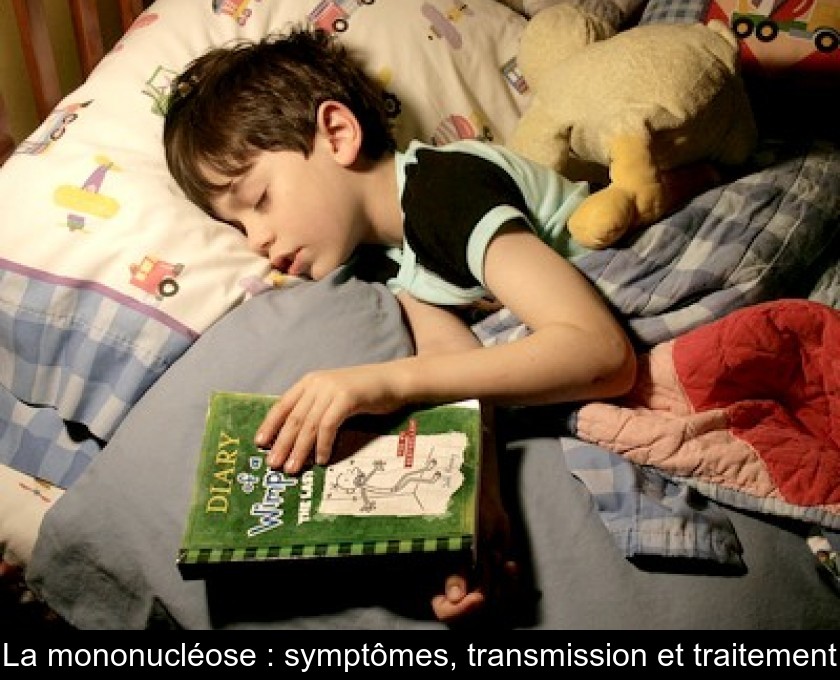 La mononucléose : symptômes, transmission et traitement La mononucléose : symptômes, transmission et traitement
