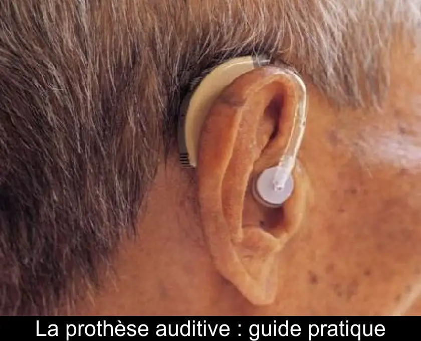 La prothèse auditive : guide pratique
