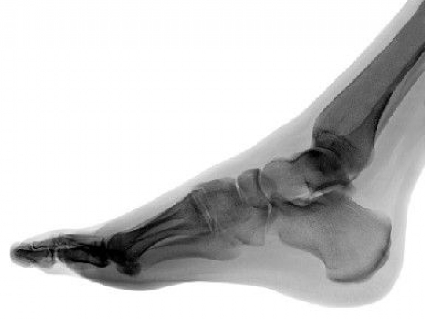 La radiographie : histoire d'une invention La radiographie : histoire d'une invention