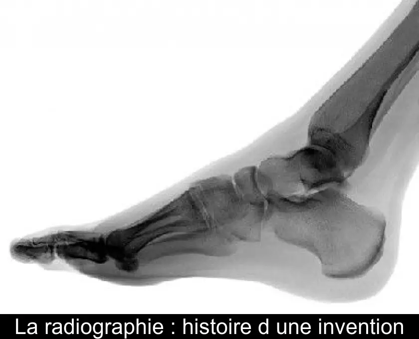 La radiographie : histoire d'une invention