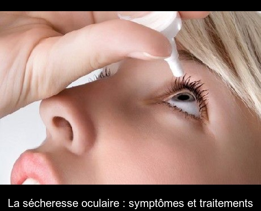 La sécheresse oculaire : symptômes et traitements