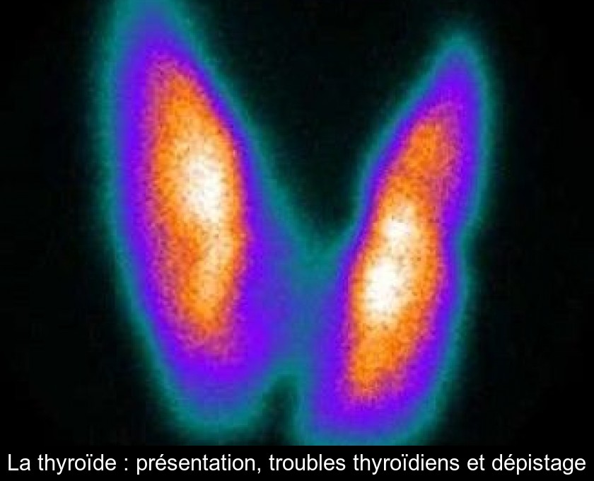 La thyroïde : présentation, troubles thyroïdiens et dépistage La thyroïde : présentation, troubles thyroïdiens et dépistage