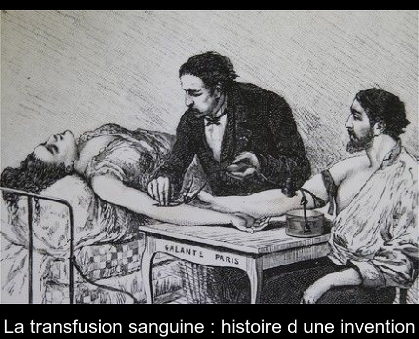 La transfusion sanguine : histoire d'une invention La transfusion sanguine : histoire d'une invention