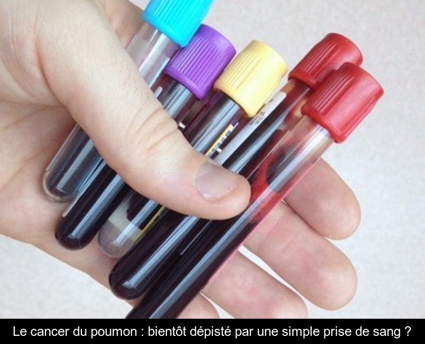 Le cancer du poumon : bientôt dépisté par une simple prise de sang ? Le cancer du poumon : bientôt dépisté par une simple prise de sang ?